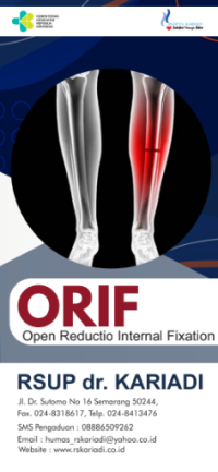 Image of Orif