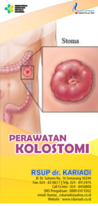 Image of Perawatan Kolostomi