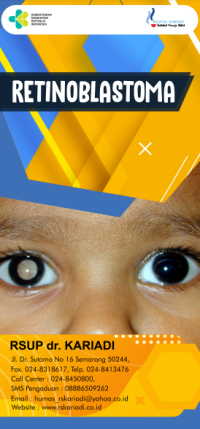 Image of Retinoblastoma